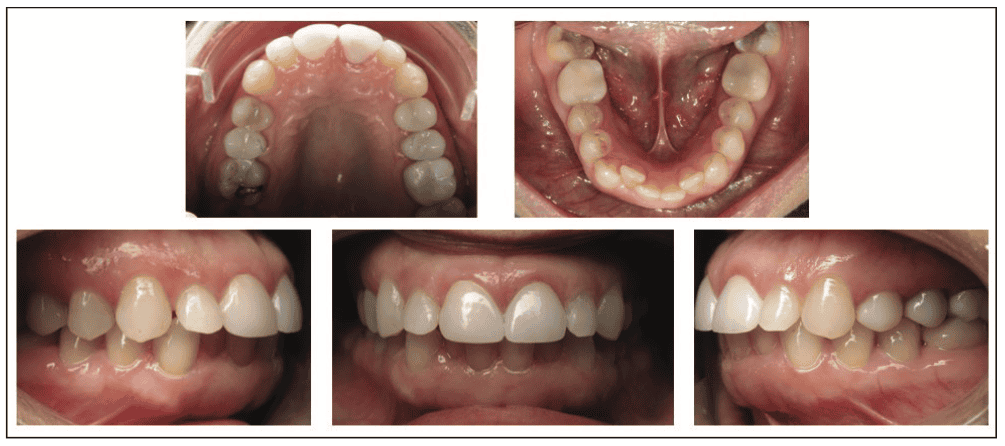 digital workflows for adult orthodontic restorative treatment
