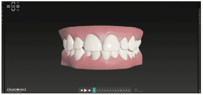 digital workflows for adult orthodontic restorative treatment