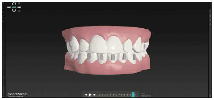 digital workflows for adult orthodontic restorative treatment