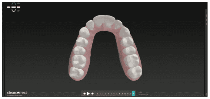 digital workflows for adult orthodontic restorative treatment