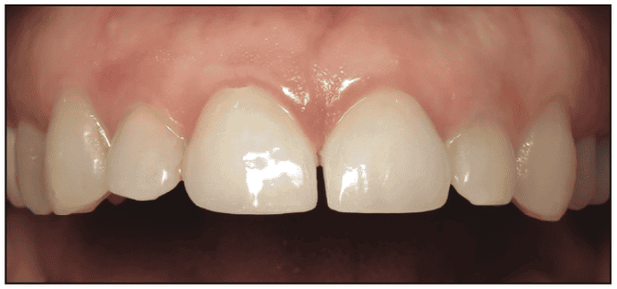 digital workflows for adult orthodontic restorative treatment