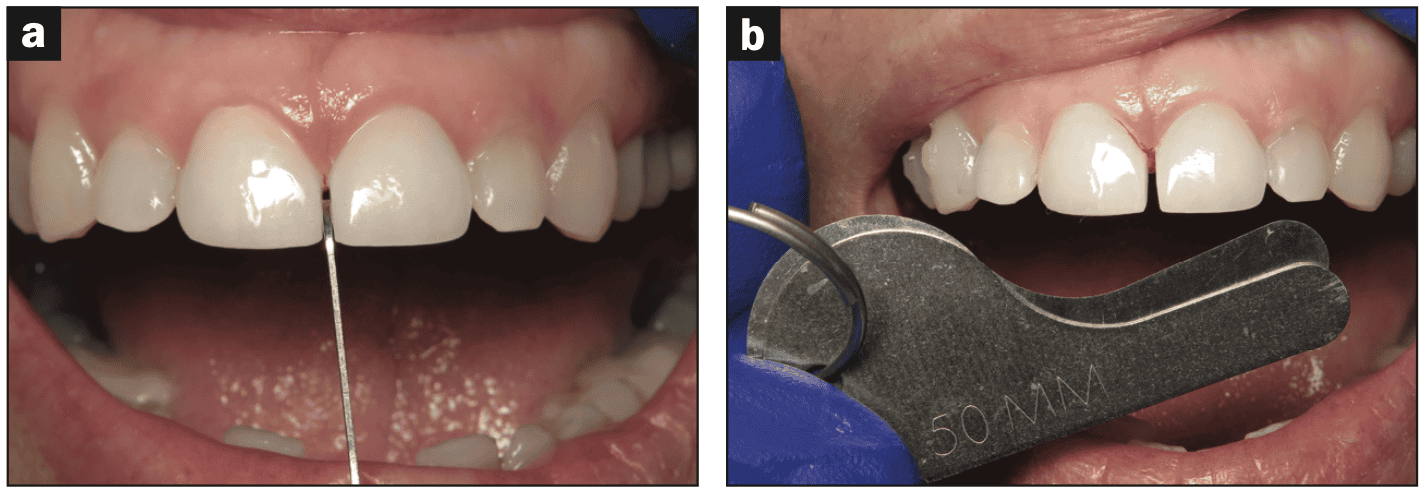digital workflows for adult orthodontic restorative treatment