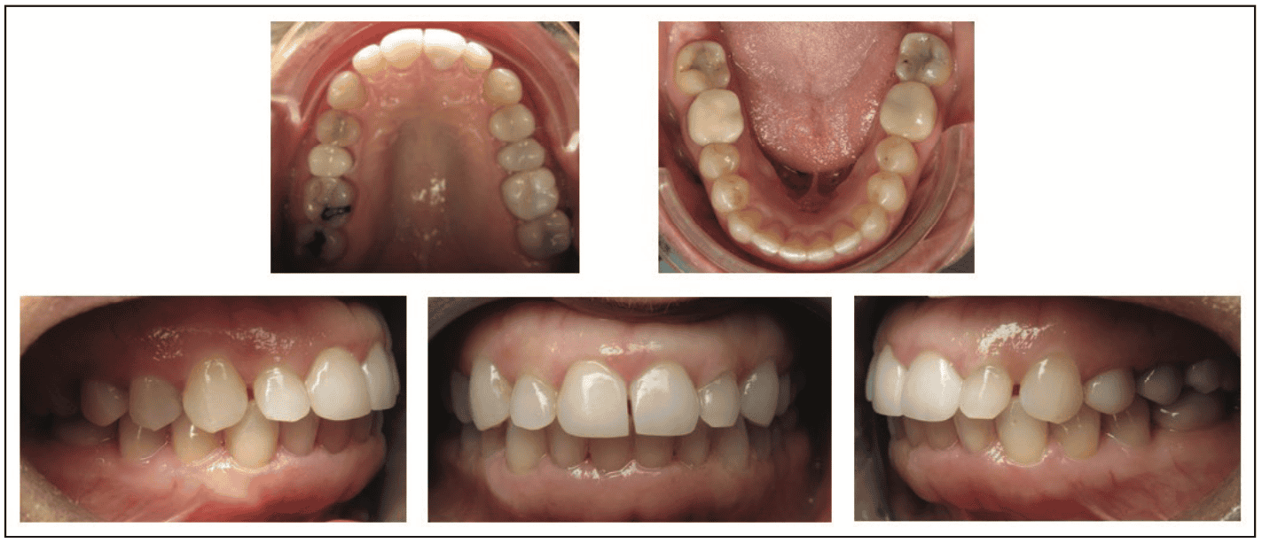digital workflows for adult orthodontic restorative treatment