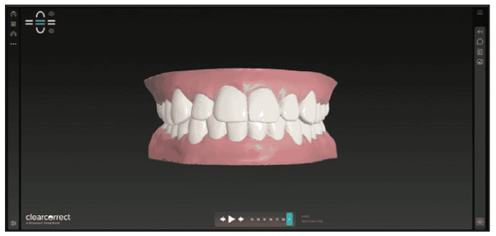 digital workflows for adult orthodontic restorative treatment