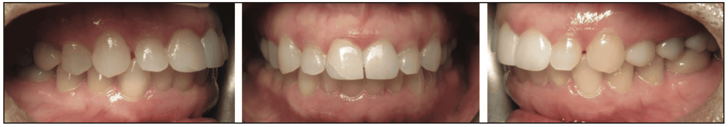 digital workflows for adult orthodontic restorative treatment