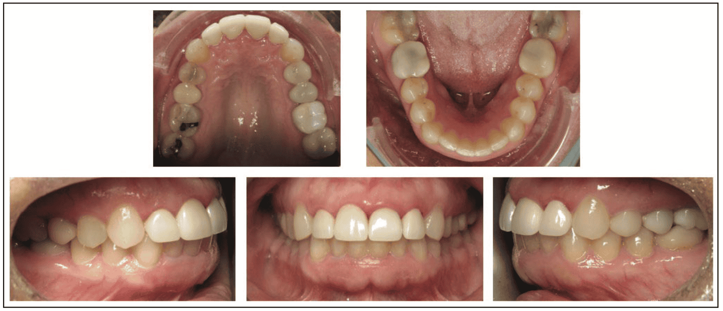 digital workflows for adult orthodontic restorative treatment