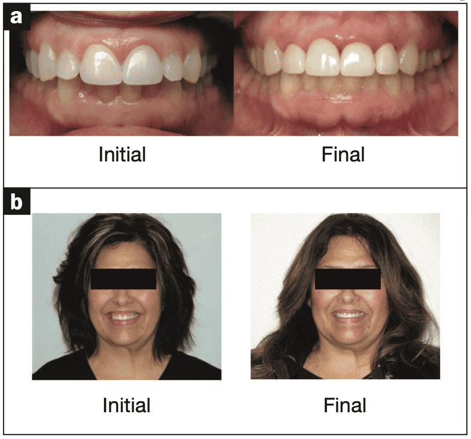 digital workflows for adult orthodontic restorative treatment